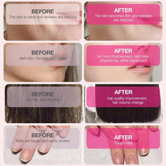 9 YOUNG-BASIC Hydrolyzed collagen peptides close-up emphasizing skin support.