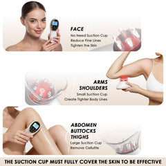 AAQ cupping attachments in use with adjustable suction for contouring