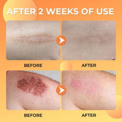 Skin texture after using ABERA Scar Removal Cream showing improved smoothness