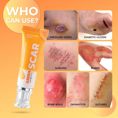 Close-up of ABERA Scar Removal Cream texture showing lightweight, non-greasy finish