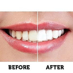 Active Wow precision tips enable targeted gel placement.