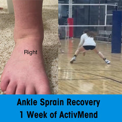 ActivMend patch applied on ankle demonstrating targeted coverage