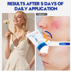 AIM Medical Eczema Relief Cream applied on elbows or knees for dry-prone areas