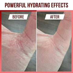 Aloe vera gel and sodium hyaluronate in Approved Science Eczaprin Balm for hydration.