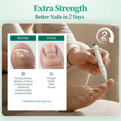 APUREE Night Pen being applied at night for repair and nourishment while you sleep.