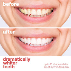 Aquasonic enamel-safe hydrogen peroxide formula protects enamel while whitening.