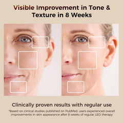ARIVEA cordless mask enables cable-free use for flexible routines.