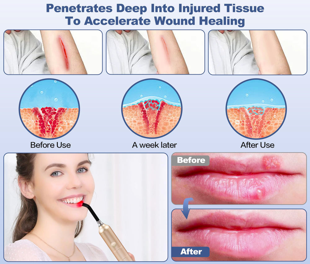Aswaysun red light wand treating joints and muscles for comfort.