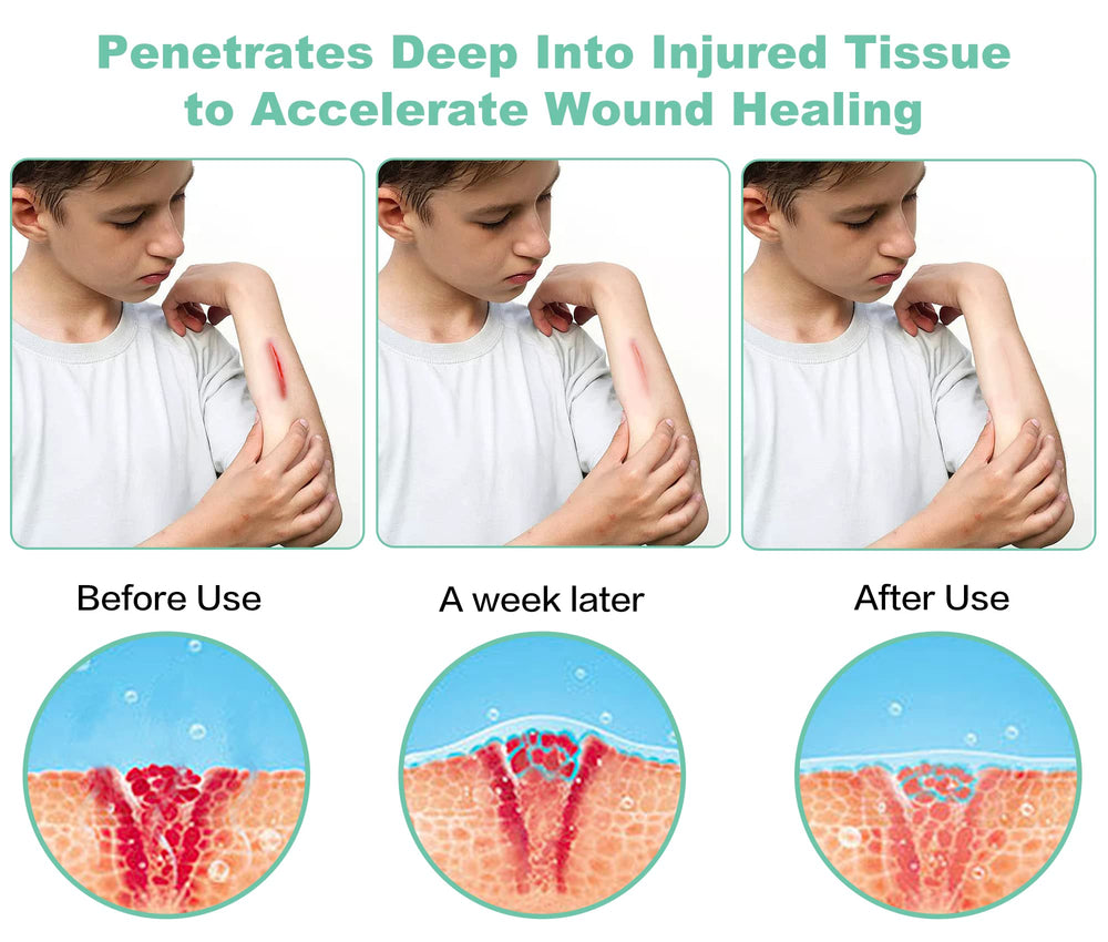 Aswaysun portable handheld design for targeted treatment on knees, wrists, and shoulders.
