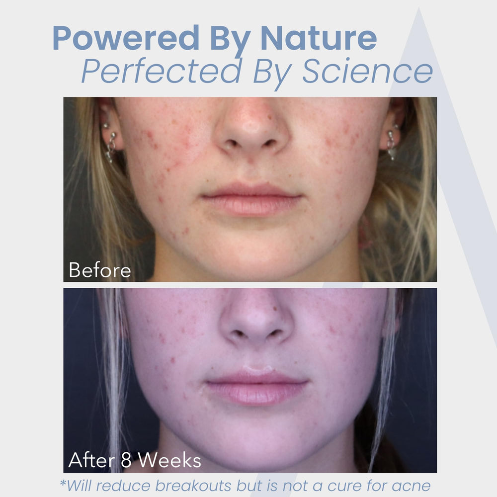 Augamis DIM-free sign highlights avoidance of estrogen-impacting compounds