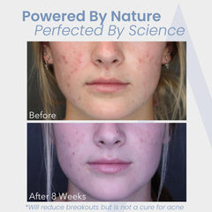 Augamis DIM-free sign highlights avoidance of estrogen-impacting compounds