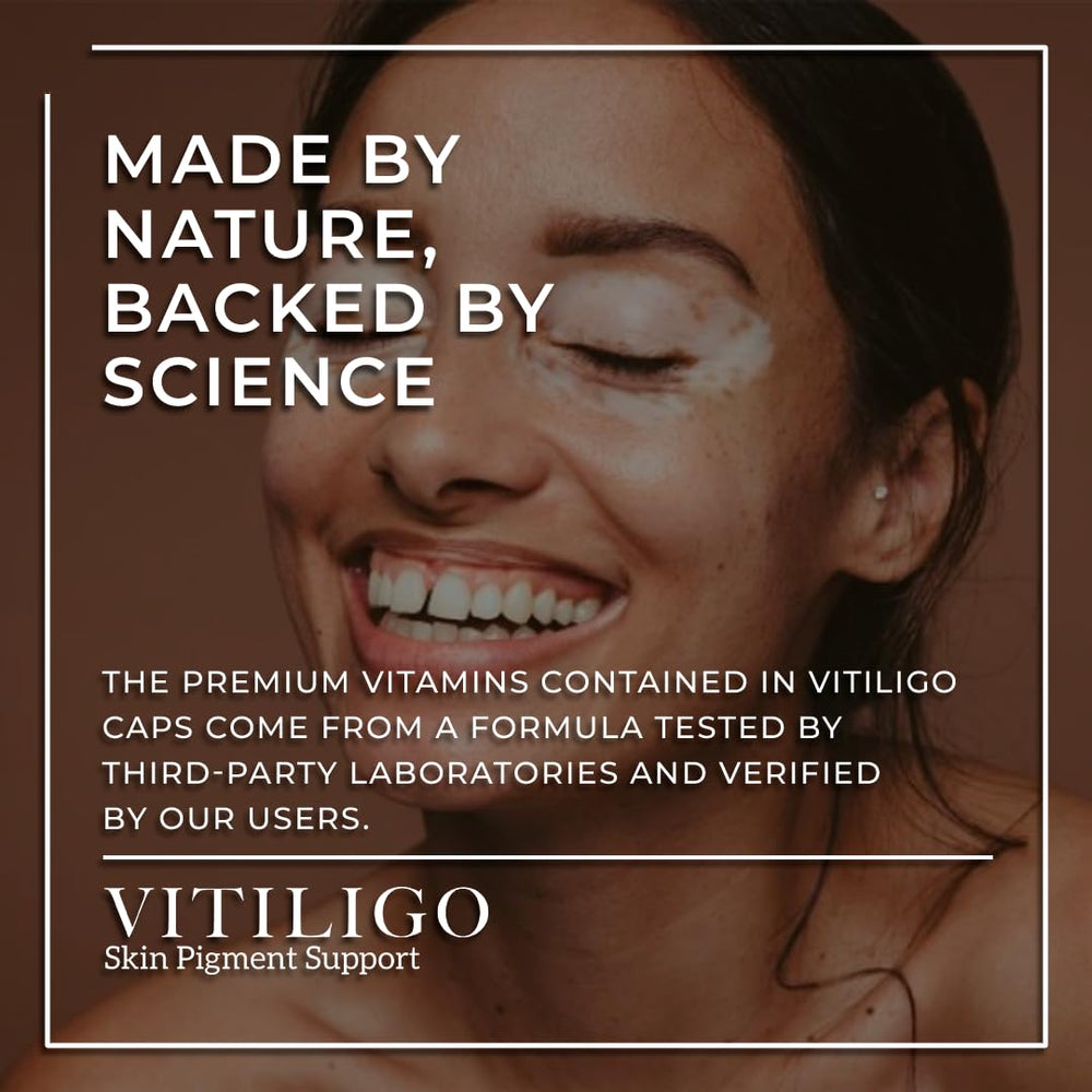 Aura Vitamins Dermawonder Vitiligo Capsules close-up shows smooth capsules for daily use.