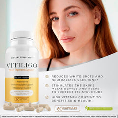 Aura Vitamins Dermawonder Vitiligo daily routine setup supports consistency.