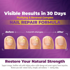 Aura Vitamins FungiTrim hands with nails after daily use appear healthier