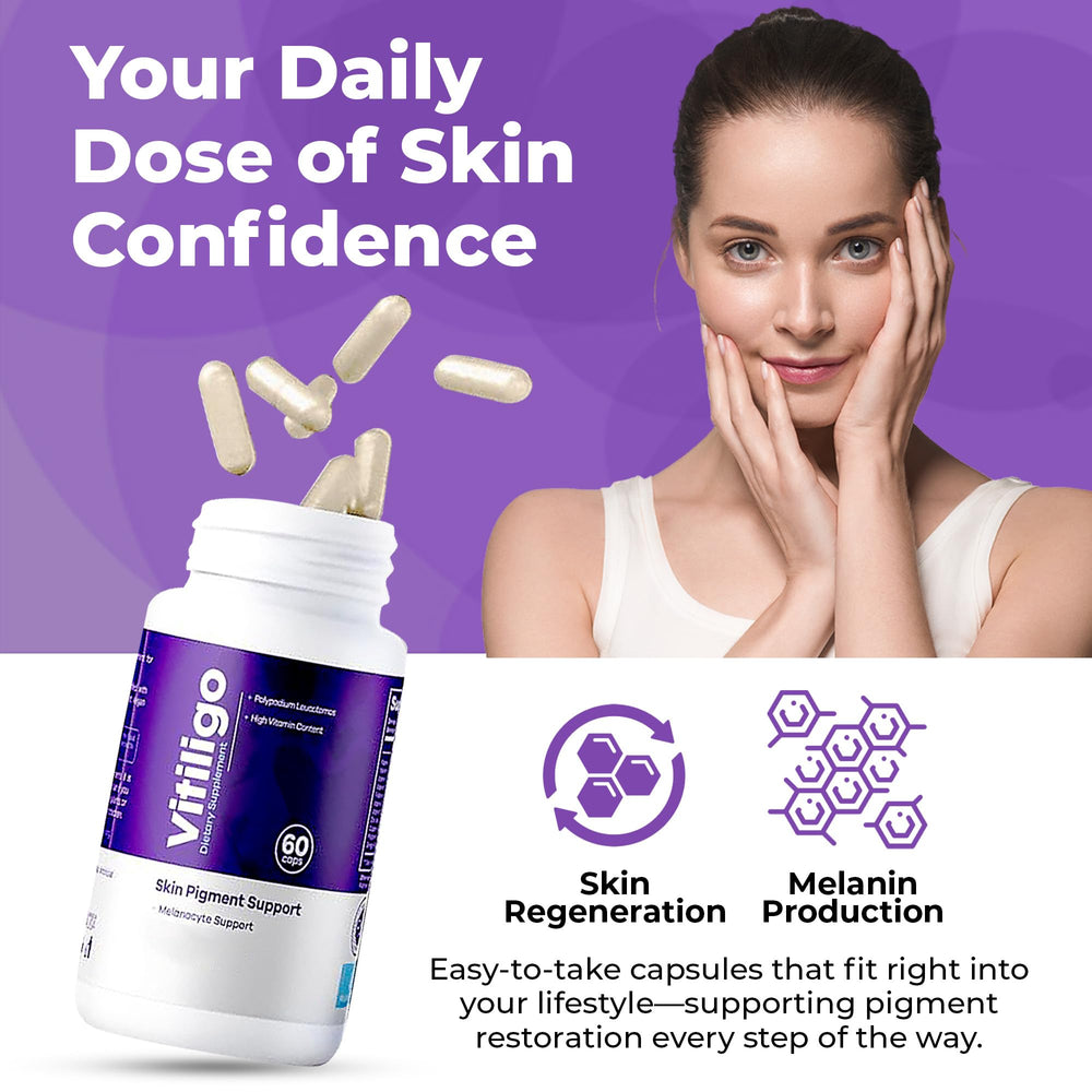 Aura Vitamins Vitiligo Capsules close-up with capsules suggests daily use convenience.