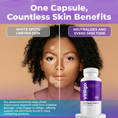 Aura Vitamins Vitiligo Capsules ingredients closeup shows vitamin C, E, zinc.