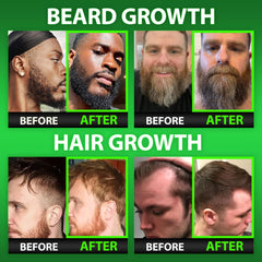 BBS Best Beard Stuff bottle cap closeup highlighting premium biotin formula benefits for beard.