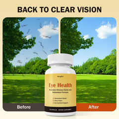 Besgiful Eye Supplement packaging display with 90 vegan capsules.