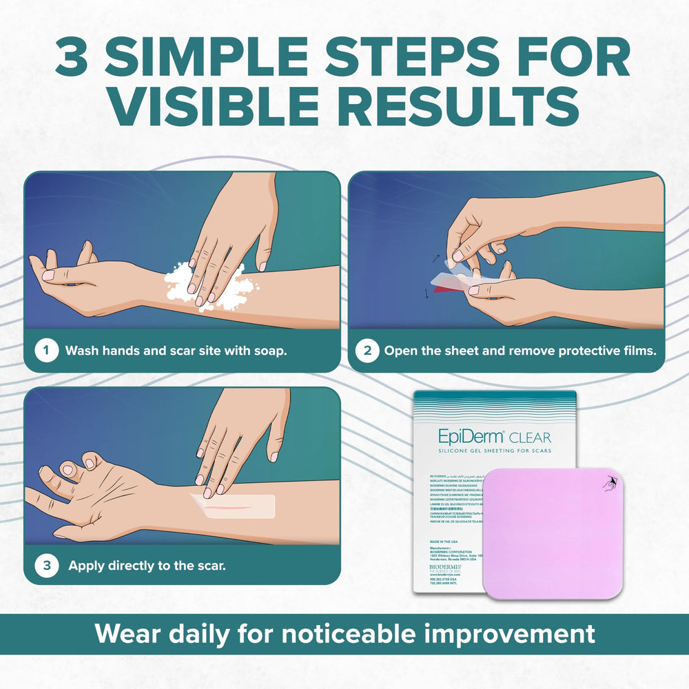 Biodermis Epi-Derm Standard Scar Sheet easy to clean and reuse over weeks.