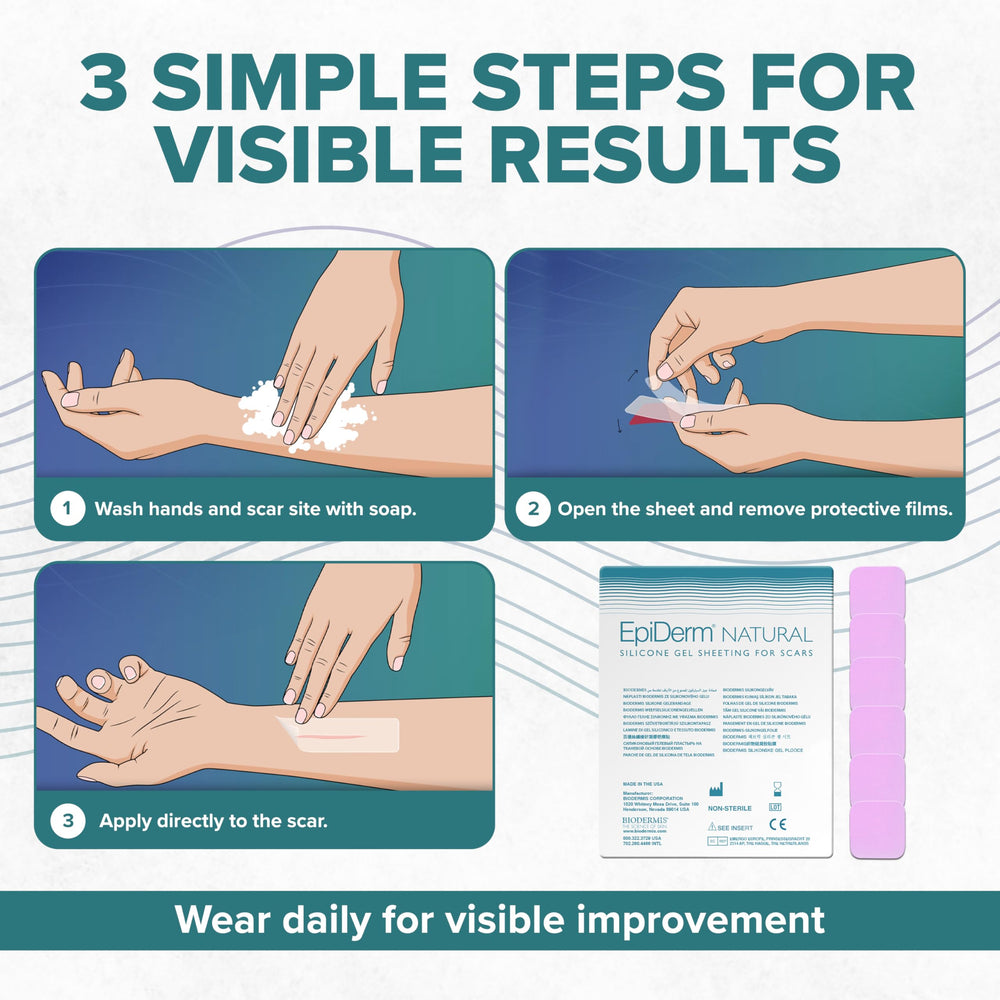 BIODERMIS Epi-Derm Epi-Tab Squares 6-pack shown for a ready scar-care kit.