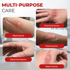 Burnshield instructional guide for confident first aid steps