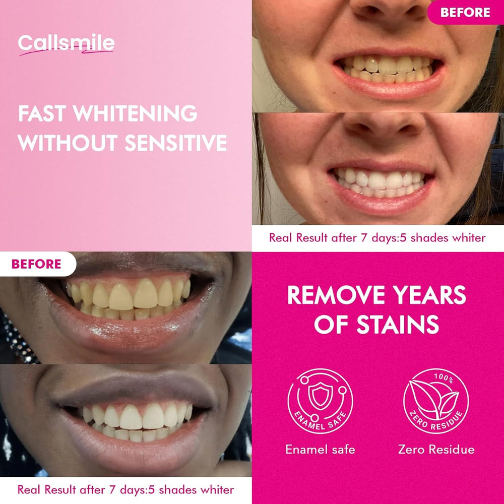 Callsmile Teeth Whitening Strips Strip Application demonstrates gentle use for sensitive enamel