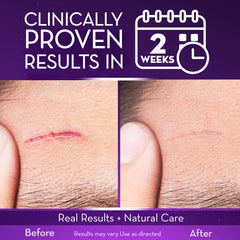 Close-up of Cicatricure gel over a surgical scar for improved appearance