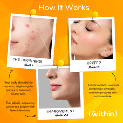 Clear Within plant-based ingredients illustration emphasizes pure, synthetic-free skincare