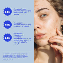 Capsules close-up showing easy daily dosing for ongoing skin support