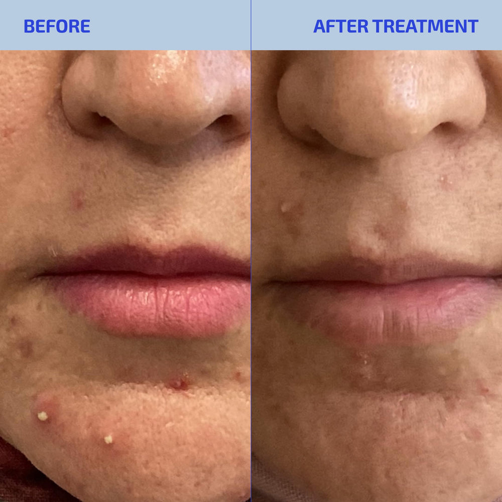 Close-up of Shaant Skin ingredients panel featuring myo-inositol and folate for balance