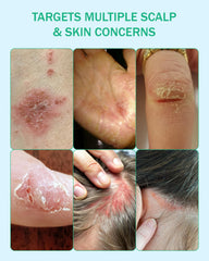 Colosderm fragrance-free gentle formula ideal for sensitive skin.