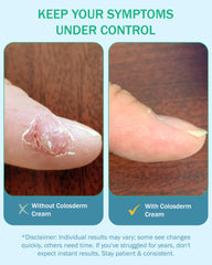 Colosderm oatmeal soothing relief targets itch for everyday comfort.
