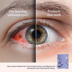 CorneaCare Rise blepharitis-support concept image for lid care