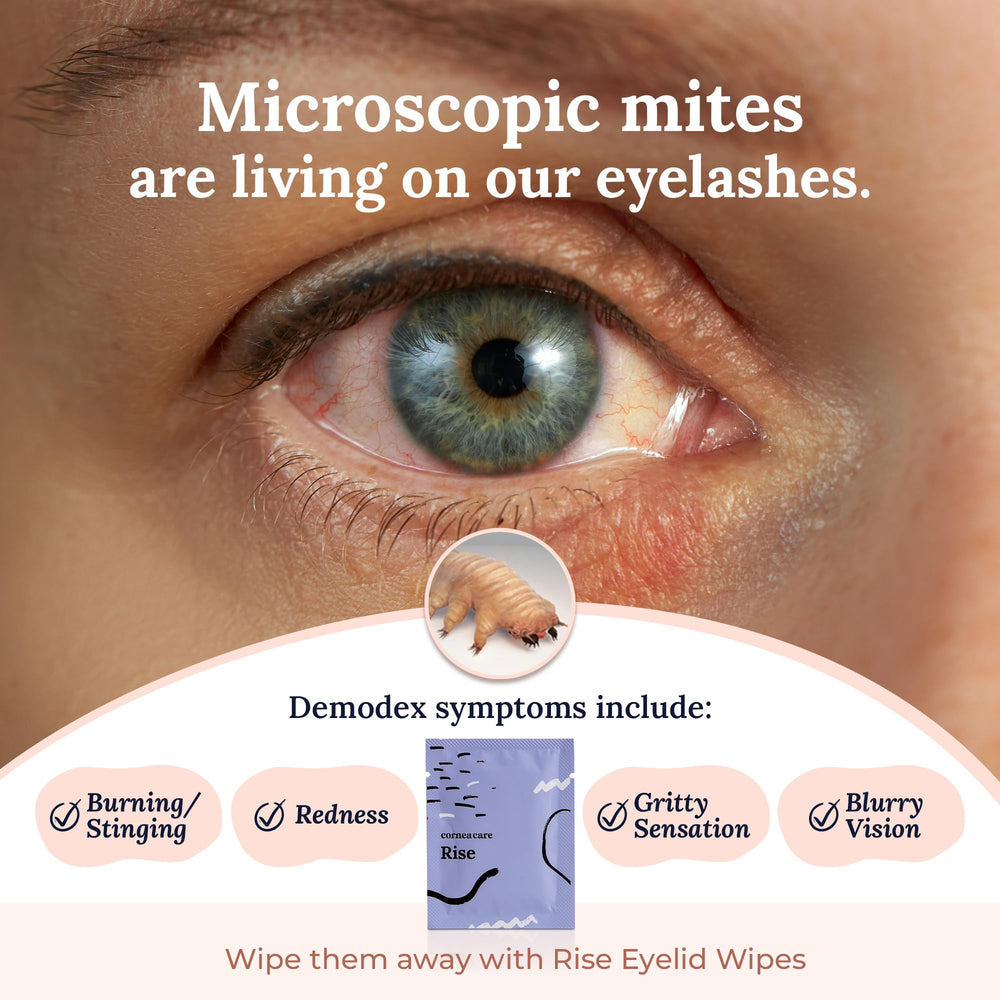 CorneaCare Rise eyelid wipe being used for delicate lid cleansing