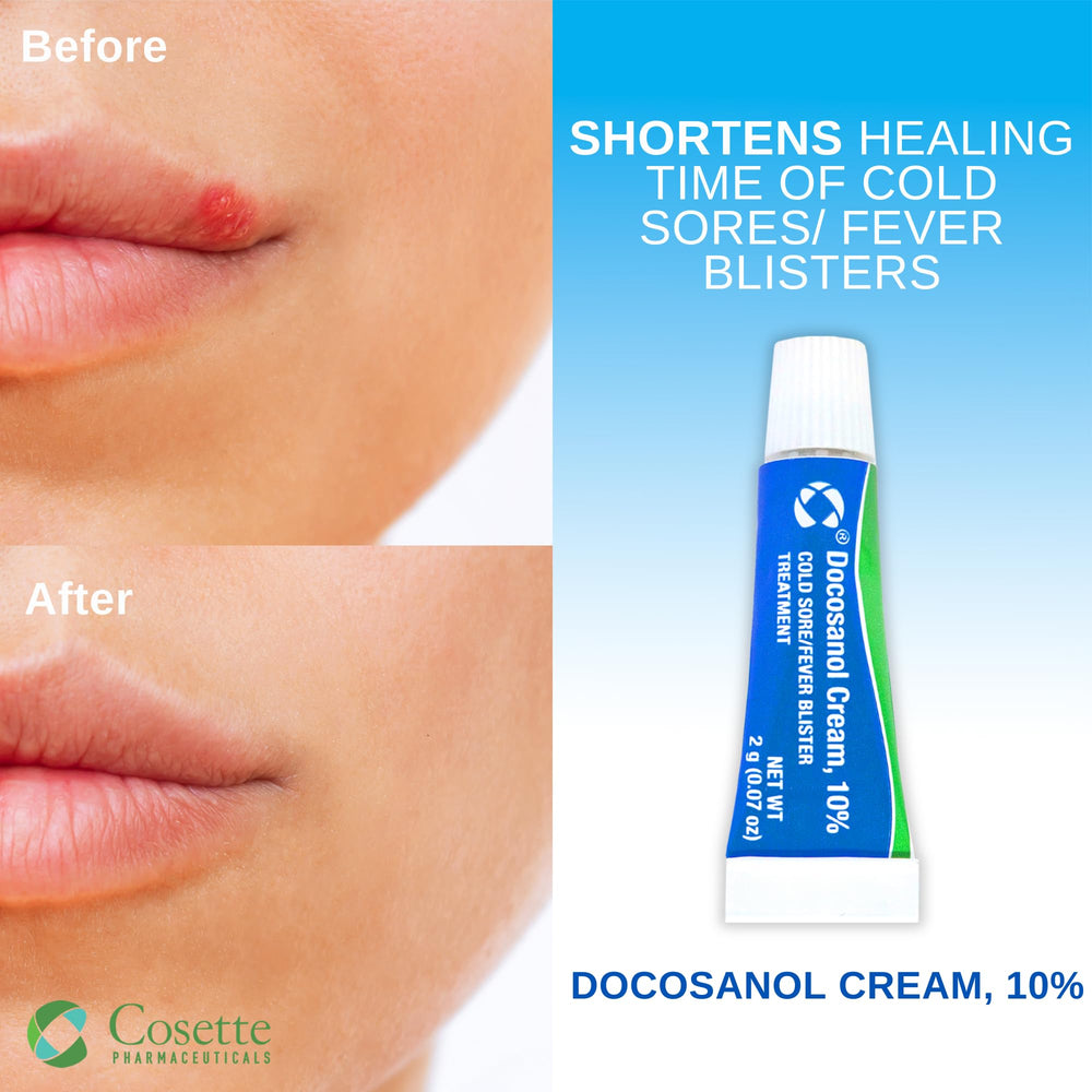 Cosette docosanol 10 percent close-up, easy-to-apply cream for affected lip areas.