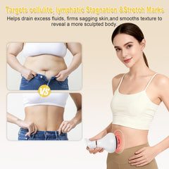 CRYSNATM anti-cellulite massage tool used on leg smooths contours.