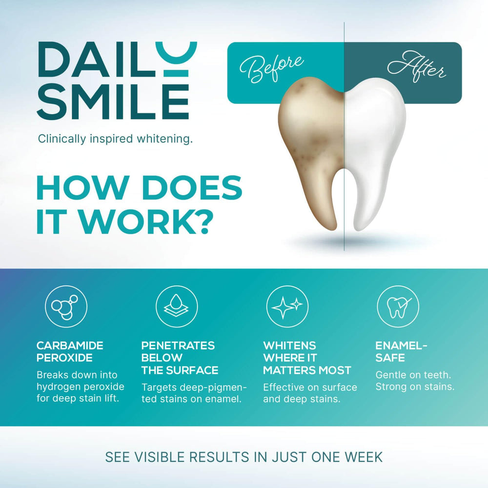 DailySmile gels target coffee and wine stains; compatible with sensitive teeth.