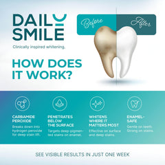 DailySmile gels target coffee and wine stains; compatible with sensitive teeth.