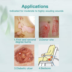 Dimora dressing applied on a wound scenario with secure border fit.