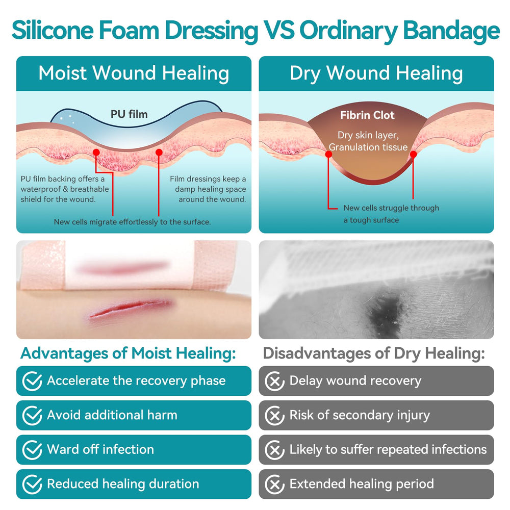 Dimora border-coverage close-up highlighting secure protection over leg ulcers.