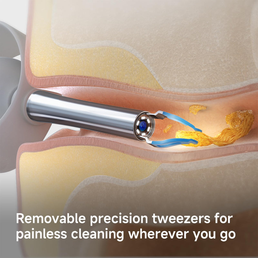 ECCLEUTH pain‑free tweezers at 15 degrees minimize contact