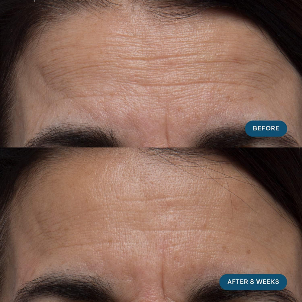ELEMIS Pro-Collagen Skin Future capsules in focus, illustrating daily use.