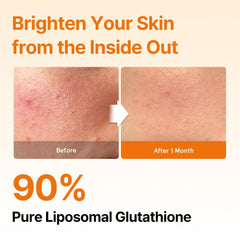 ESTHER FORMULA Liposomal Glutathione Strips supporting liver wellness and antioxidant balance