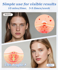 EVFOFO blue-light mode on the mask for surface clarity and tone improvement.