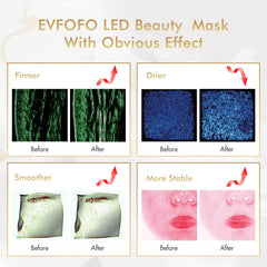 EVFOFO red light mask LED array close-up with dual wavelengths