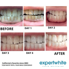 Expertwhite made in USA badge on packaging signals quality and safety.