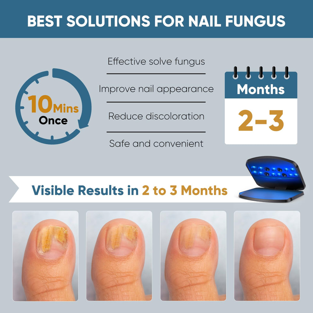 FEIGOMA device in use on foot for at home nail care