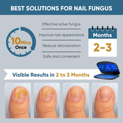 FEIGOMA device in use on foot for at home nail care