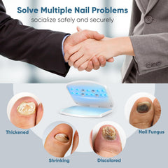 FEIGOMA Nail Fungus Light Device foot inside for toenail care