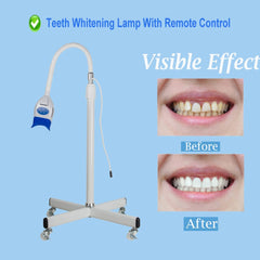 Fencia Teeth Whitening Machine remote control enables hands-free operation